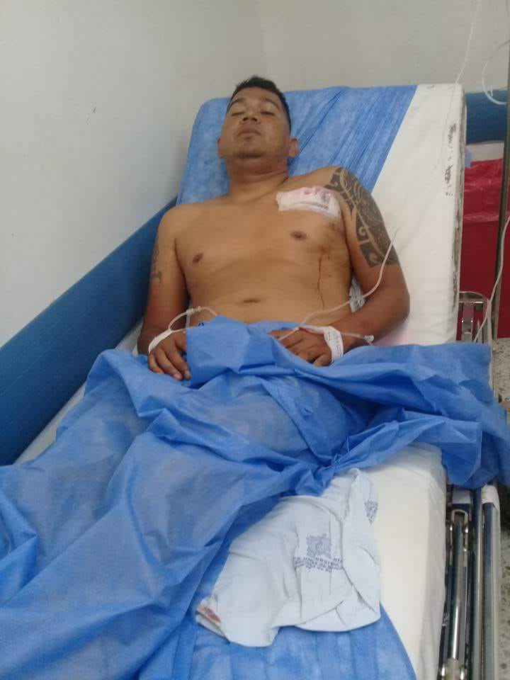 Reinaldo luego de ser herido a bala en septiembre del 2017. 