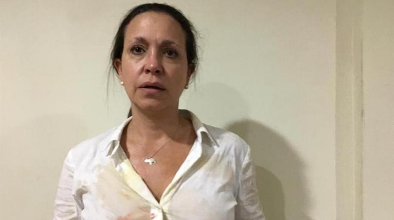 La dirigente opositora María Corina Machado tras sufrir el ataque.
