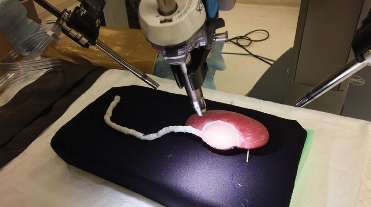 Réplica impresa en tres dimensiones (3D) de un riñón.