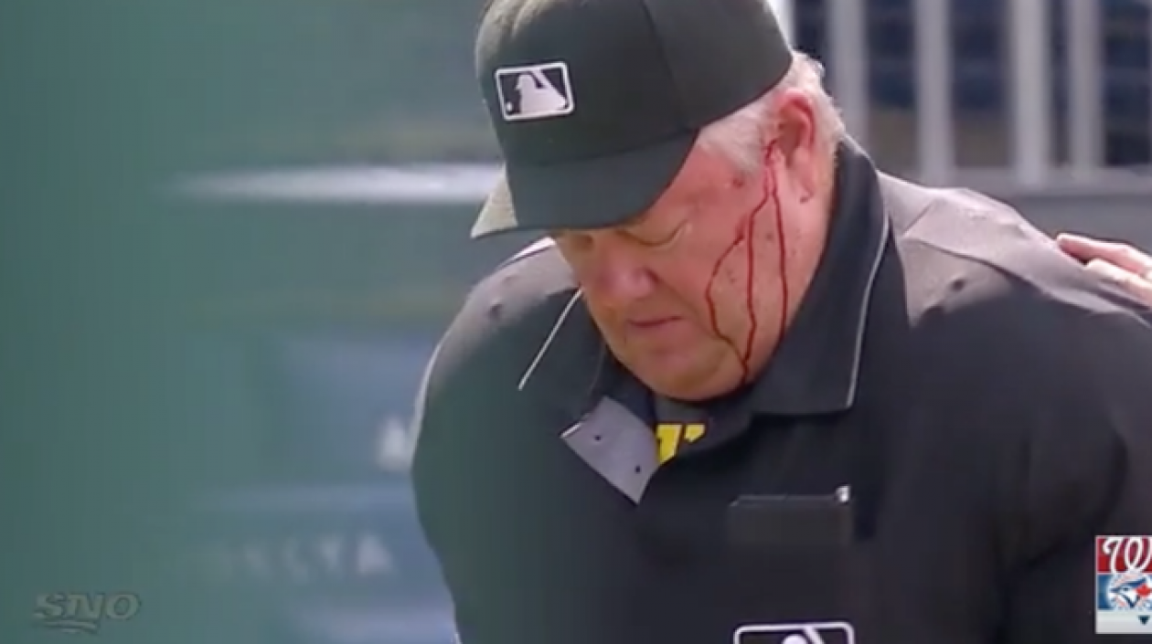 El árbitro de Grandes Ligas Joe West, herido en la cabeza.
