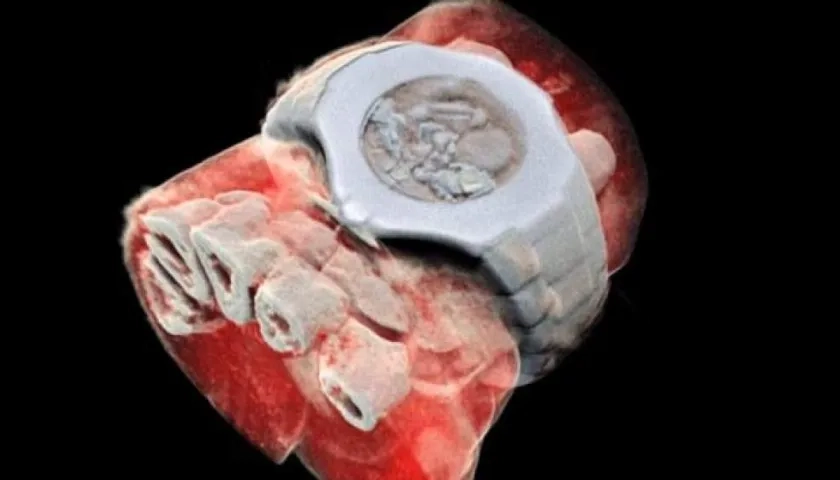 Radiografía 3D y a color Radiografía en 3D y a color.