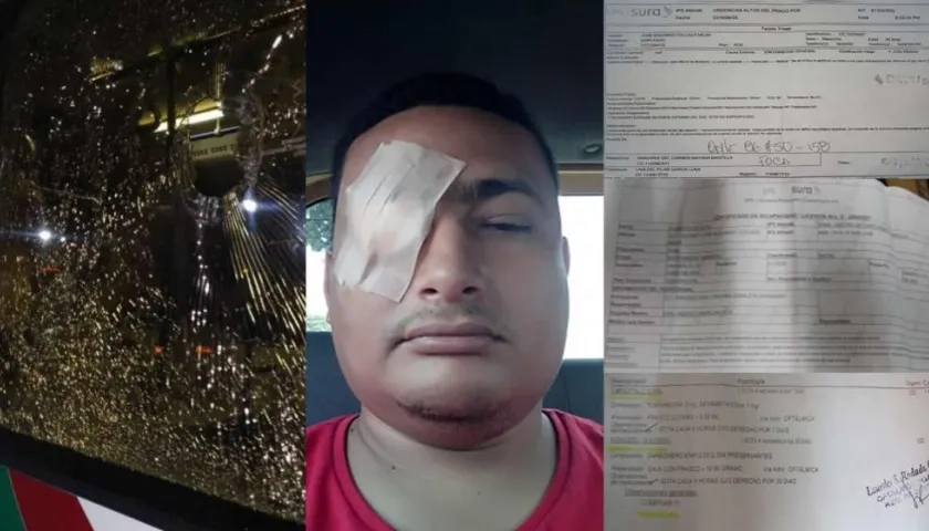 José Eduardo Collazo Mejía, el usuario que sufrió lesiones en su ojo derecho tras  el ataque a un busetón de Transmetro