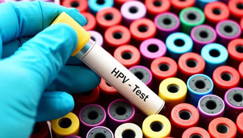 Existen más de 200 tipos de VPH, aunque solo un pequeño grupo de ellos es de alto riesgo.
