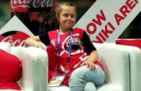 Angelina Makárova, niña con síndrome de Down. 