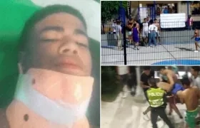Lucas Daniel Fontalvo Rodríguez, el joven que recibió un fuerte batazo en una riña.