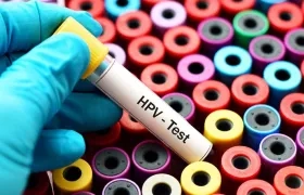 Existen más de 200 tipos de VPH, aunque solo un pequeño grupo de ellos es de alto riesgo.