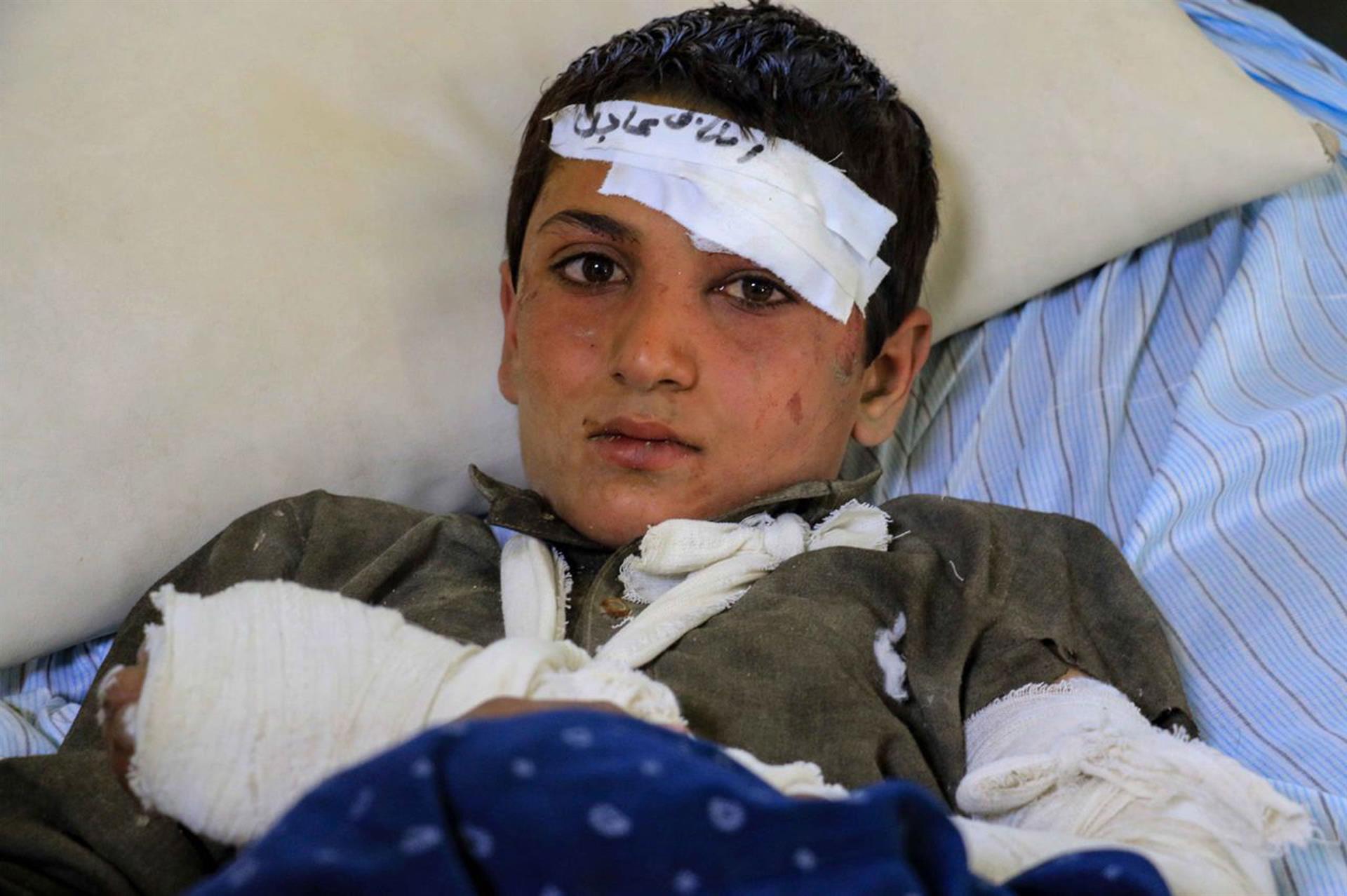Un niño afgano herido permanece en hospital de Paktia. 