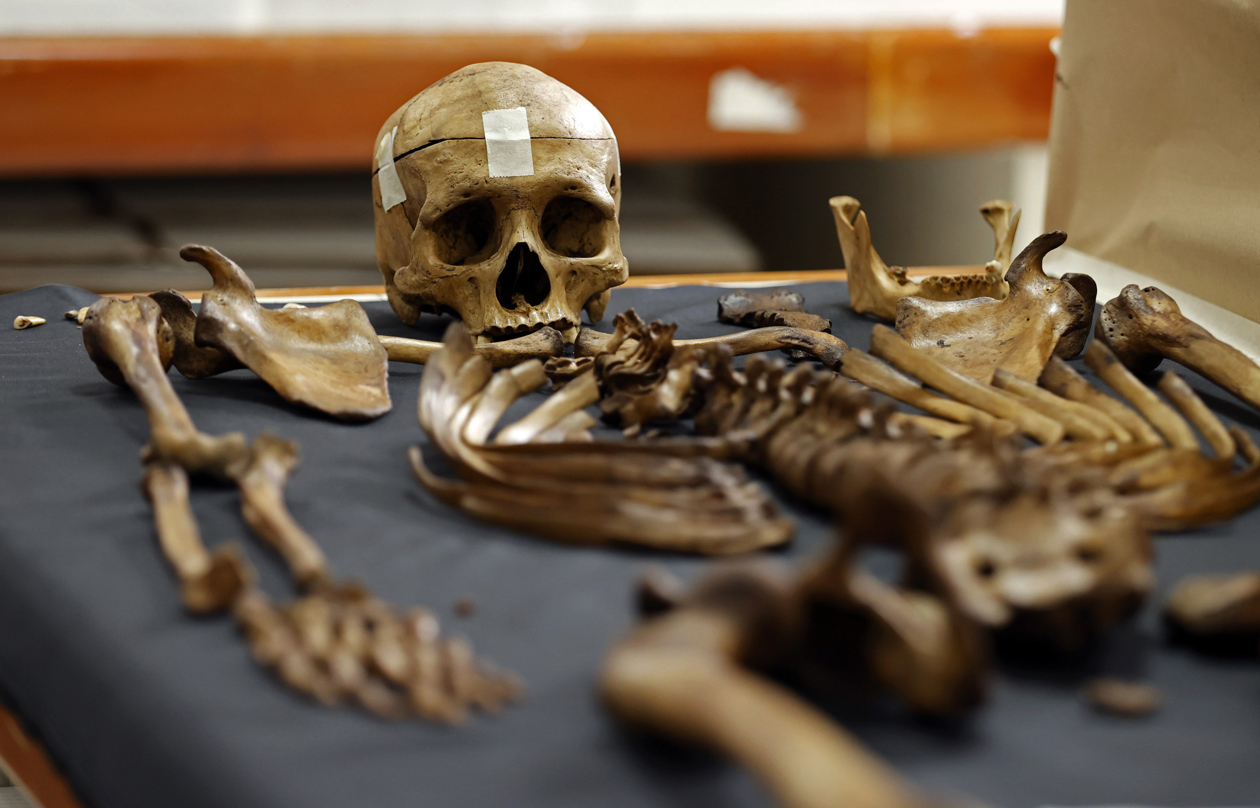 Partes óseas sobre una mesa en la sede de Medicina Legal.