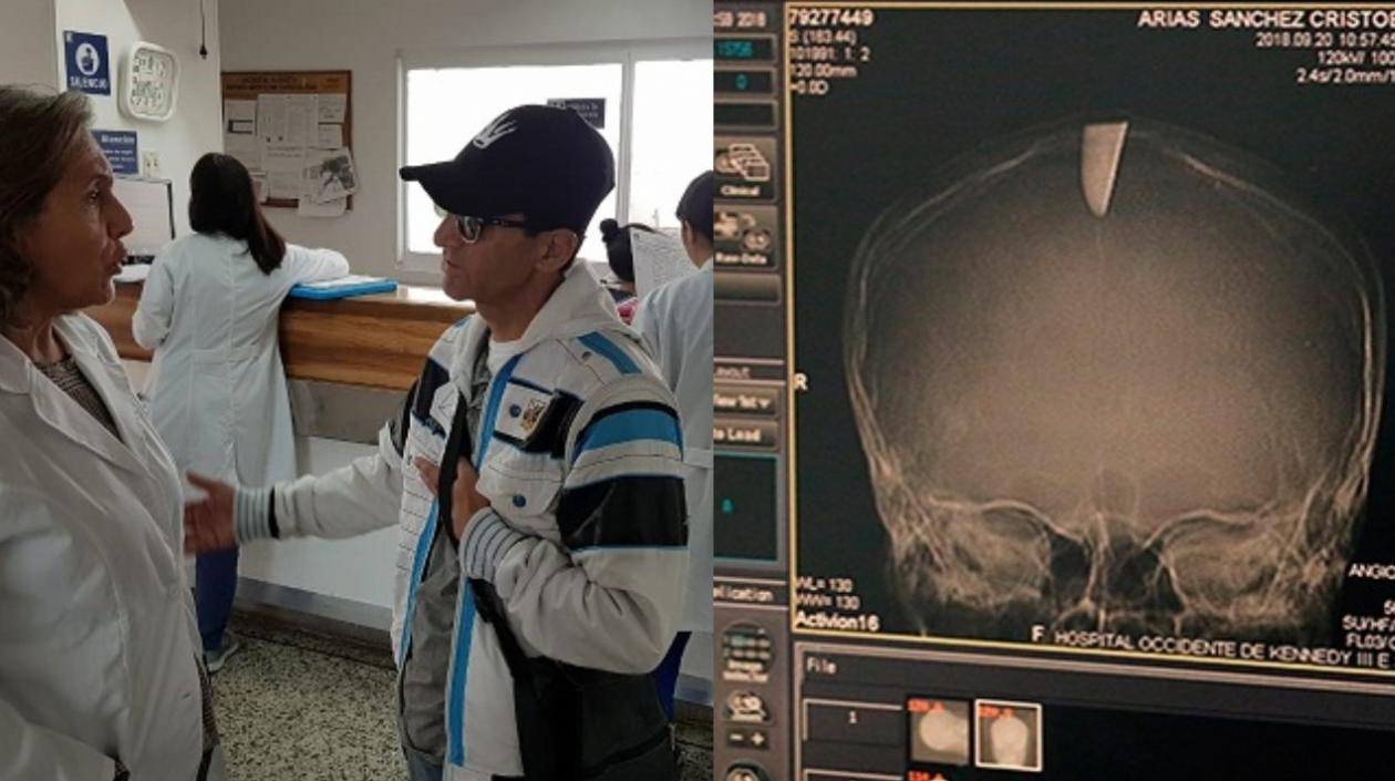 Cristóbal Arias se salvó gracias a la atención médica inmediata en el hospital Kennedy de Bogotá.