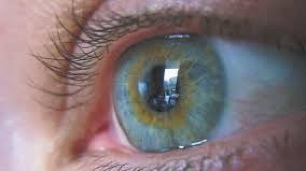 los pacientes que sufren esta enfermedad pueden tener problemas con el nervio óptico.