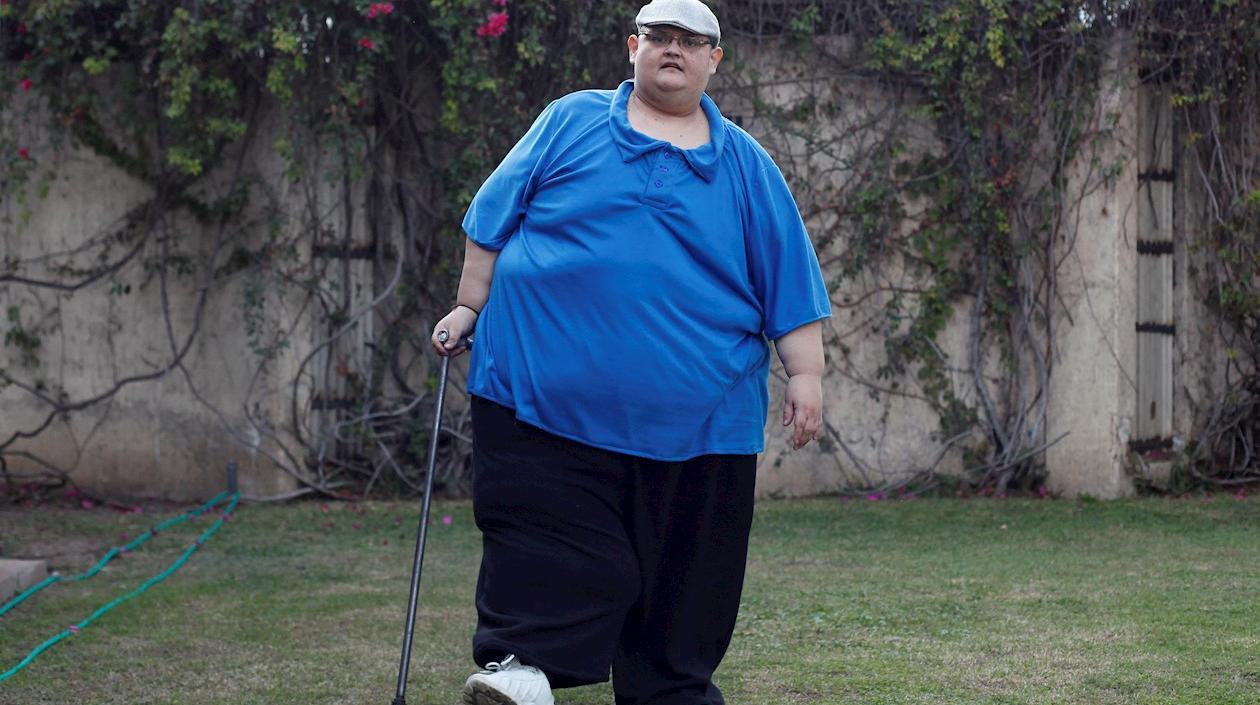 Juan Pedro Franco fue en una época el hombre más obeso del mundo.