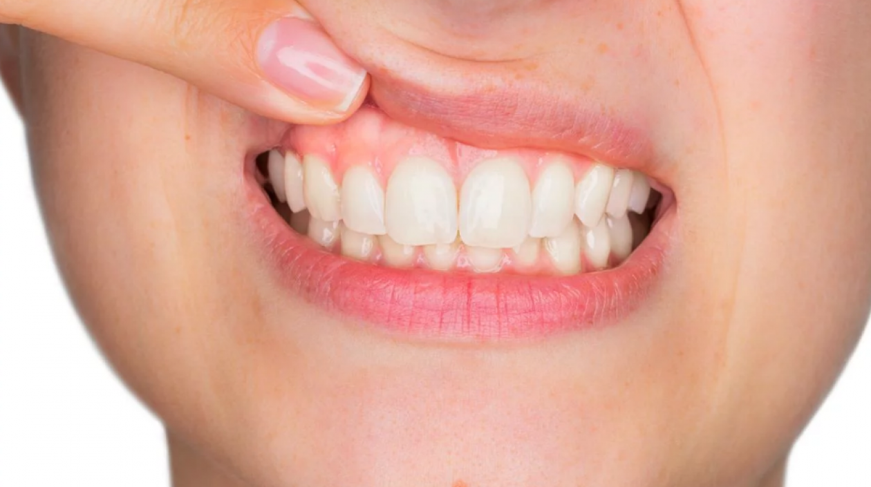 El lavado de los dientes después de comer es una de las recomendaciones de los odontólogos.