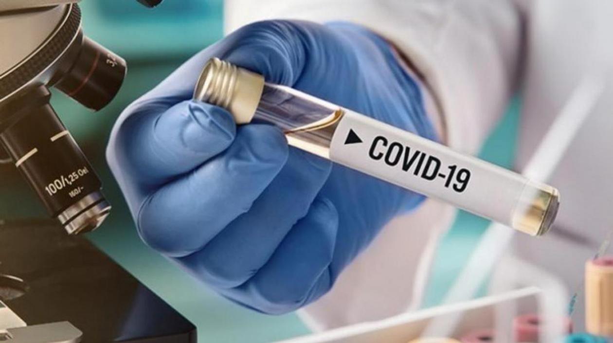 Colombia realizó más de 57 mil pruebas entre ayer y hoy para detectar más casos de Covid-19.