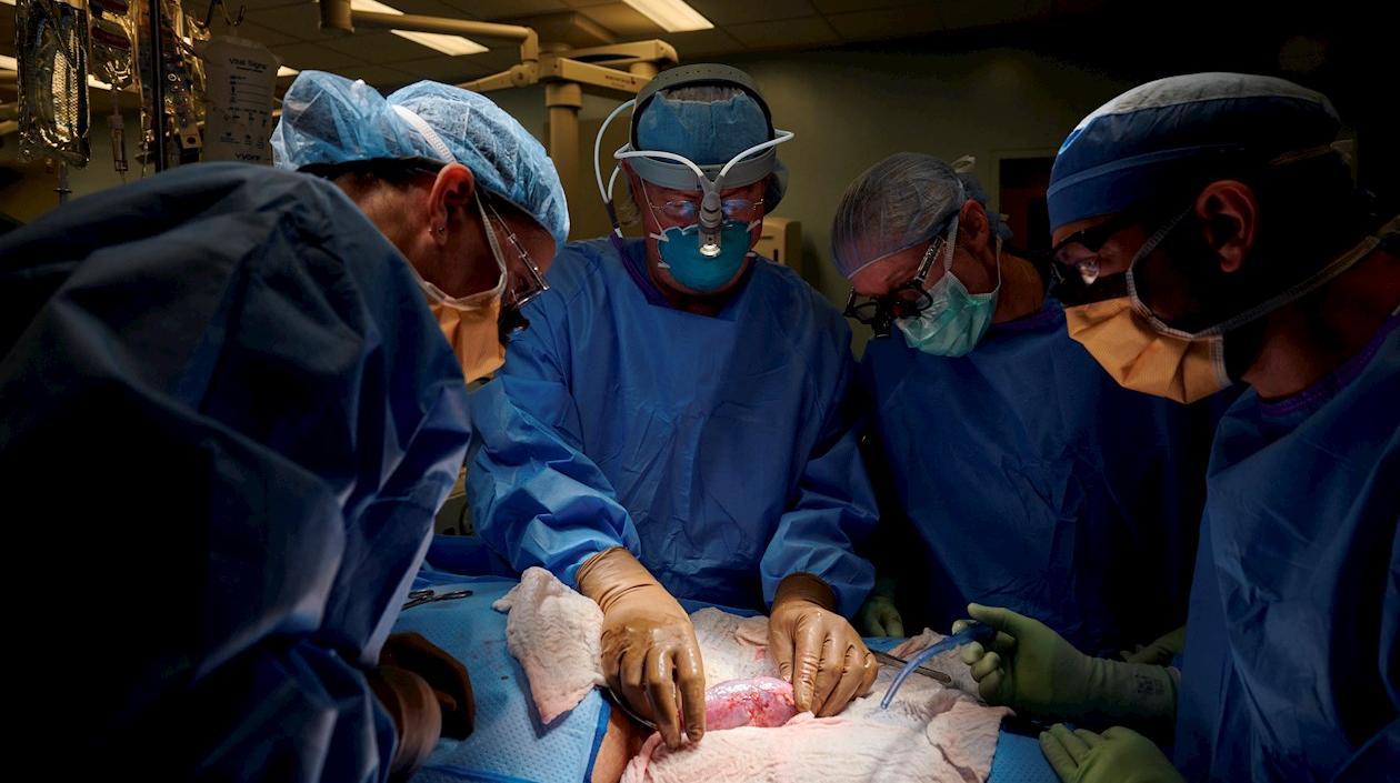 el Dr. Robert Montgomery, junto al equipo quirúrgico mientras realizan el primer xenotrasplante de un riñón de cerdo a un ser humano