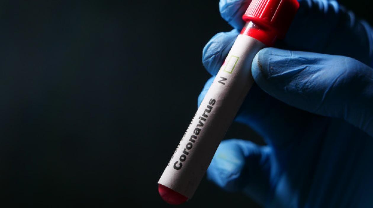 Las pruebas de Covid-19 en Colombia llegaron a 106.889 en los laboratorios.