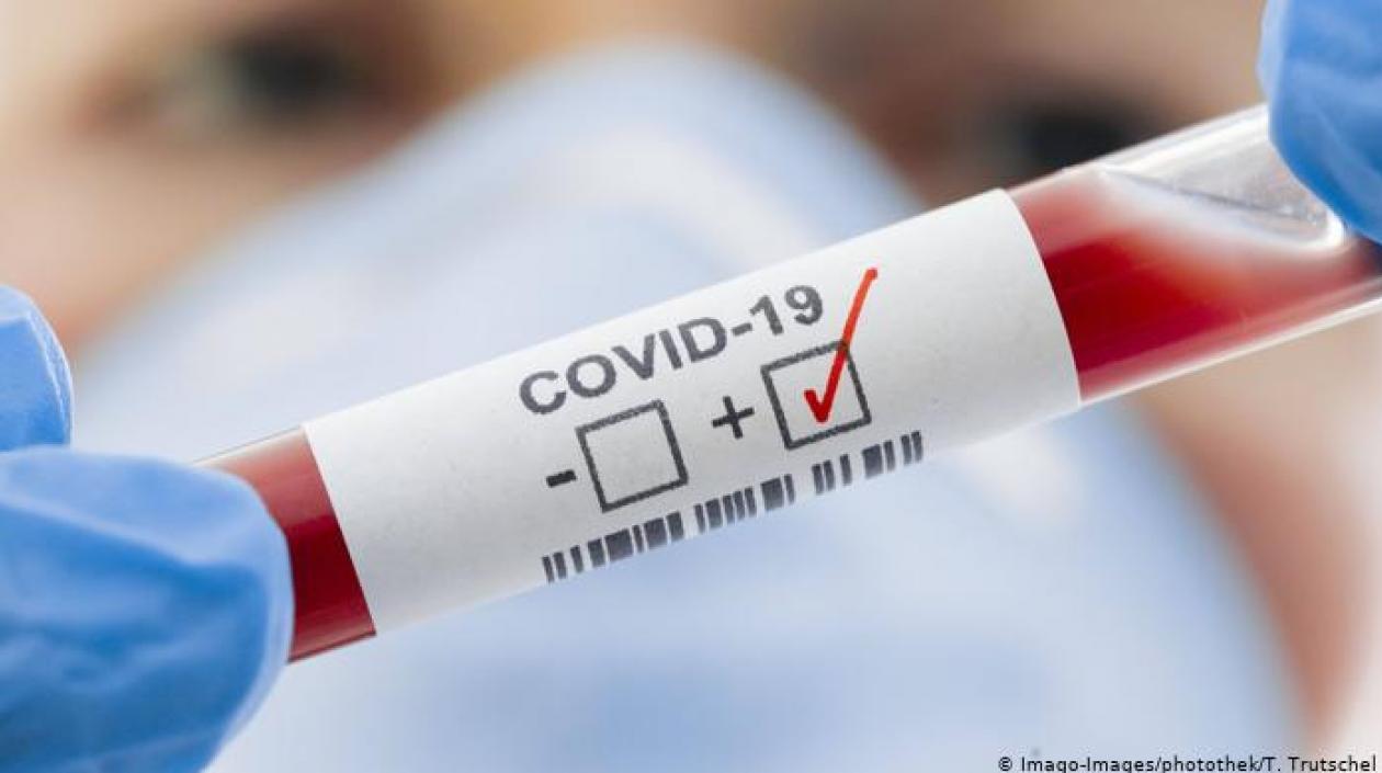 Siguen los testeos en Colombia para detectar nuevos casos de coronavirus.