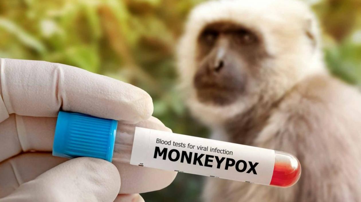Varios países ya han empezado a vacunar contra la viruela del mono.
