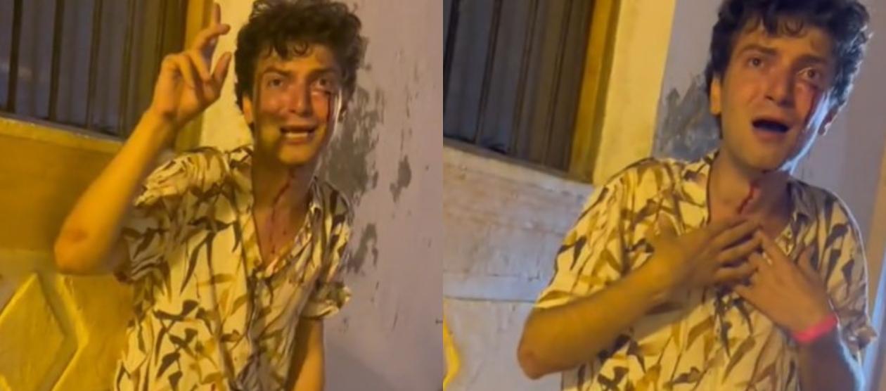 Turista que habría sido víctima de atraco en Cartagena.