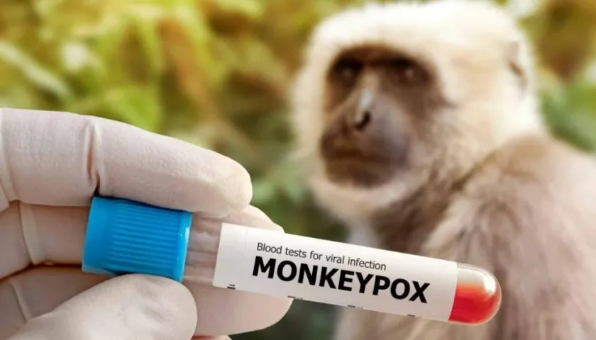 Varios países ya han empezado a vacunar contra la viruela del mono.