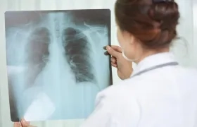 Colombia es el quinto país de la región con mayor carga de casos de tuberculosis.