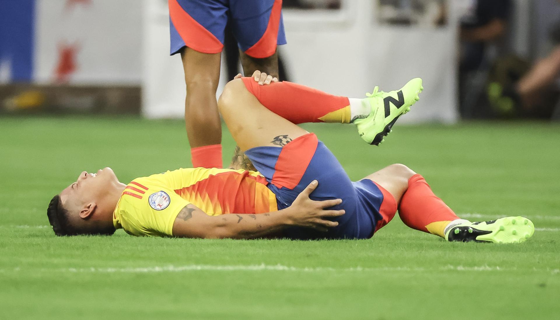 James Rodríguez  al quejarse de un golpe que recibió durante el partido contra Paraguay. 