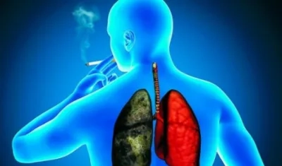 El 80 % de los pacientes de cáncer de pulmón sobreviven menos de dos años.